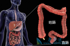 ��Ī«����/��Ī¬�����������ƽ�ֱ����Ч������