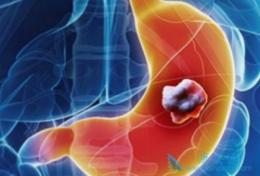 ��Ī«����(Ramucirumab)���׸��������Ƽ�������ʧ�ܺ�θ����ҩ��