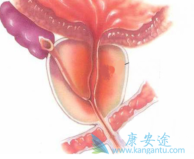 阿比特龙 阿比特龙