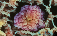 ������ͻ��ķΰ����߿��Է��ÿ�������(Crizotinib)