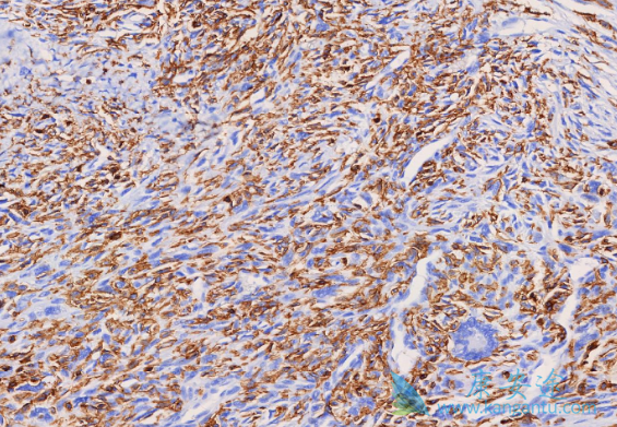 尼洛替尼 尼洛替尼