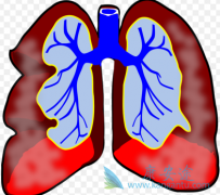 ����ҩ�ﲨ��̹(TRACLEER)���������ƶ�ͯ�ζ�����ѹ��