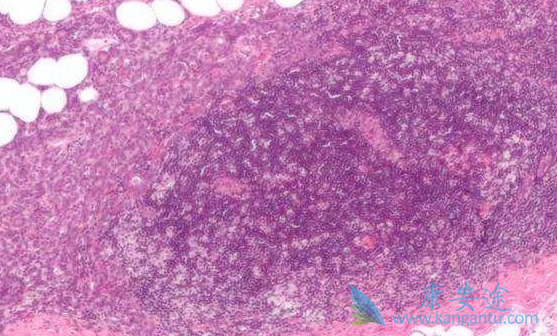 ��Ī����