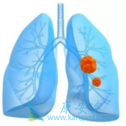 ������(Crizotinib)�����Ʋ�ͬALK����ʱ����Ч�Ƿ��в��