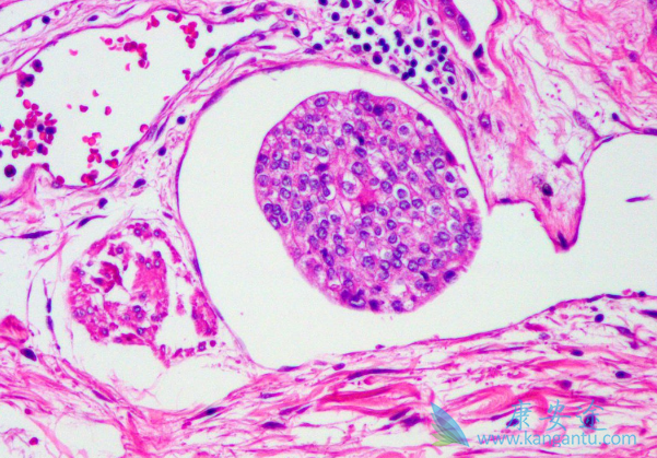 派姆单抗 派姆单抗