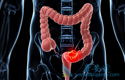 帕尼单抗 帕尼单抗
