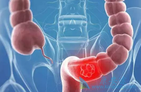 西妥昔单抗 西妥昔单抗