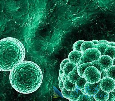 凡德他尼 凡德他尼