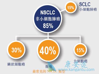 小细胞肺癌 小细胞肺癌