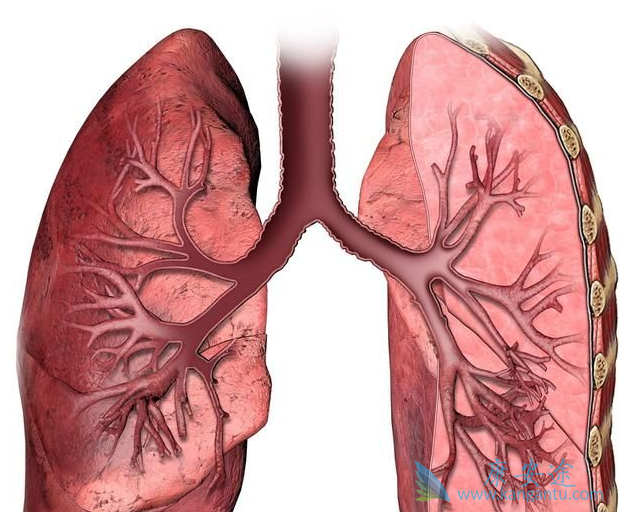 克唑替尼 克唑替尼