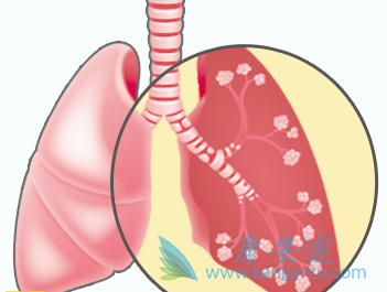 肺纤维化 肺纤维化