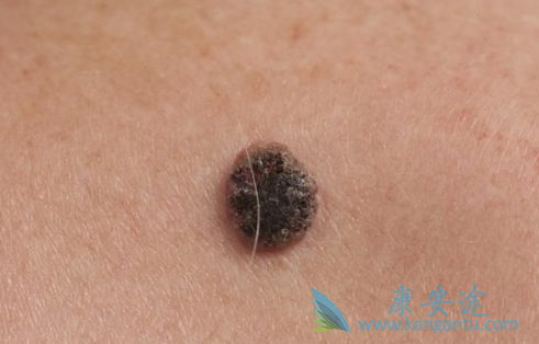 ���޷���