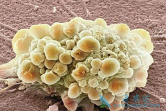 ��Ī������߱����鵥��(Bevacizumab)���ƽ���������Ч��