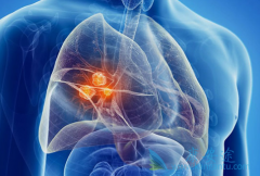 ̩��ɳ(Tagrisso)�������ܹ����Կ��Ʋ���