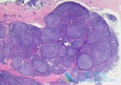 ��������������������/���޻������������ܰ������ߵ���Ч��