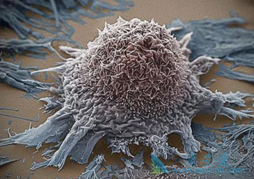 卡博替尼 卡博替尼