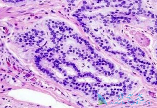 凡德他尼 凡德他尼