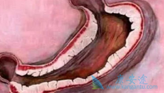 ��׼�����������鵥��(Herceptin)��ʹ���߻�ø��õ�������