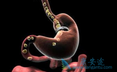 ��Ī«����(Ramucirumab)����һ�߻����ܸ���ʳ�ܰ����ߵ���������