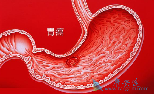 瑞格菲尼 瑞格菲尼