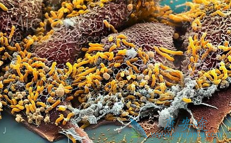 依维莫司 依维莫司