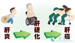 ����(hcv)���Ҹ�(hbv)������Щ��ͬ��