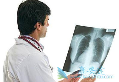 舒尼替尼 舒尼替尼