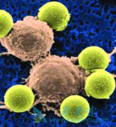 ������(Imatinib)�����ڼ仼��Ҫ���Ӳ�����Ӧ���������̶ܳ�