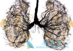 �ΰ����߼������ð�������(GILOTRIF)��Ч�Ƿ���½�