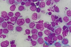 ���ǶȰ�/�����׵õ�ҩ���Ƴ���Tϸ����Ѫ����Ӧ�ʿ͹�