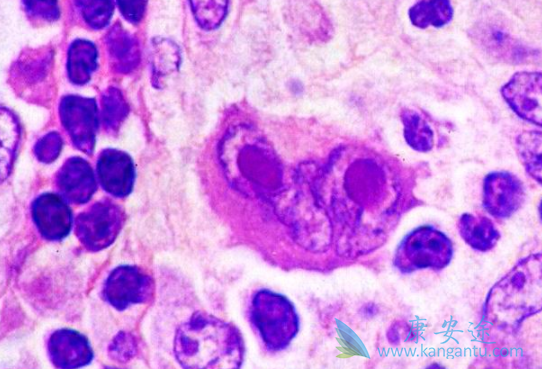 本妥昔单抗 本妥昔单抗