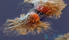 ���ڴ����ʹ�ü��ػή��PD-1���Ƽ�����Ч