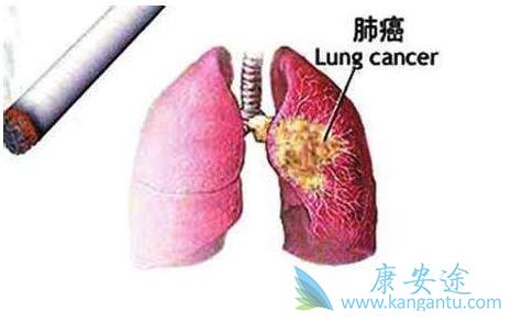 �ΰ�����