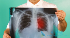 ��������(brigetin)�԰���������ҩ���ߵļ���������Ϊ67%