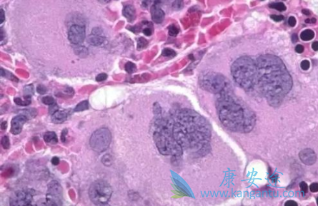 ³������