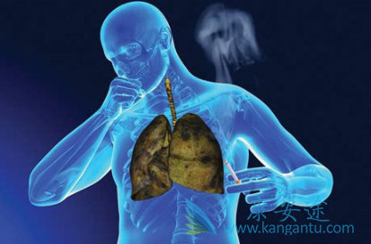 卡博替尼 卡博替尼