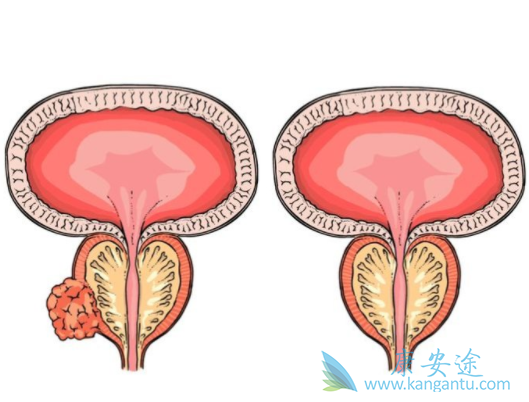 ����³��