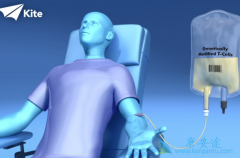 CAR-T�Ʒ��ľ������û�����ʲô��