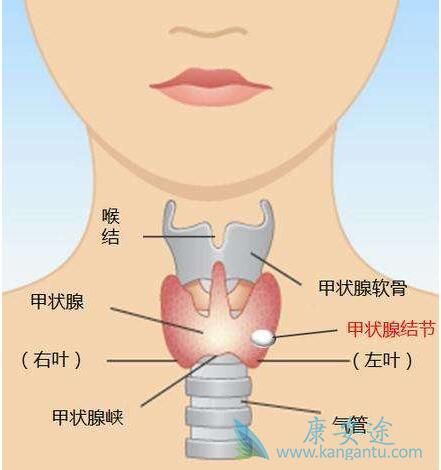 甲状腺癌症状 甲状腺癌症状