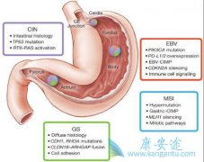 �����ǲ������Ű�֢״֮һ�����Ű�������Щ֢״��