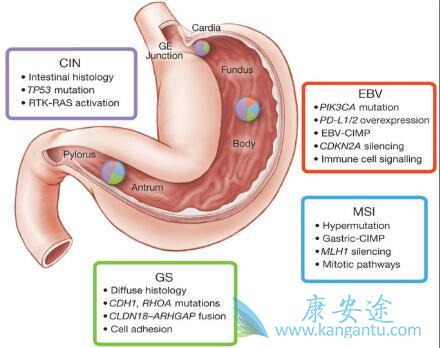 贲门癌症状 贲门癌症状
