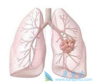 奥希替尼 奥希替尼