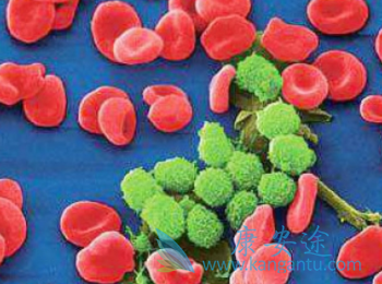 依鲁替尼 依鲁替尼