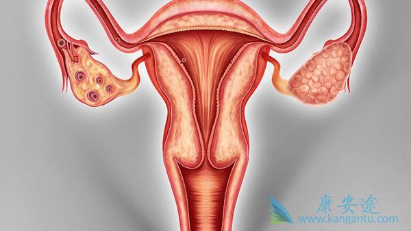 卵巢癌 卵巢癌