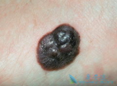 ���˺�ɫ�����ܻ��ã�Ӱ���ɫ�����������ڵ���������Щ