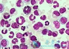 ������ϸ����Ѫ�����߳��ڷ�ҩ����Ч���������