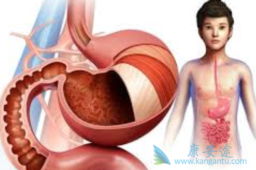 胃肠间质瘤 胃肠间质瘤