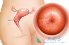 ������֢״����Щ�����ͨ���¾�֢״�ų�������