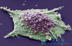 ����Сϸ���ΰ����߿���ѡ��PD-L1�������ϻ��Ʒ����ӻ�������չ