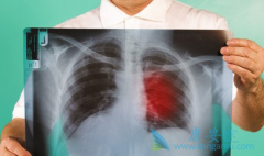 �ΰ�ɸ���Ƿ��ܹ��ӳ�Զ�ǶȽ��ͷΰ����ߵ��������գ�